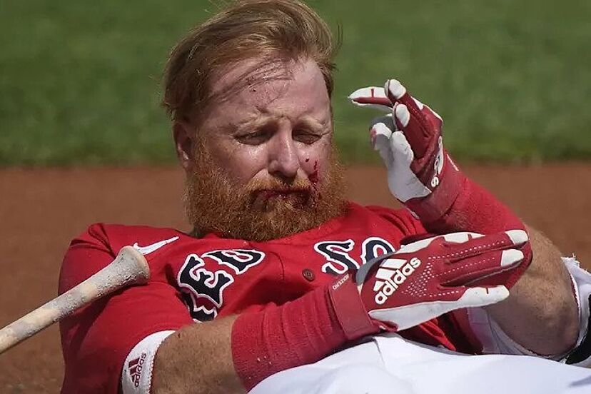 Heartbreaking News: Justin Turner Will Not Play Again Due to……